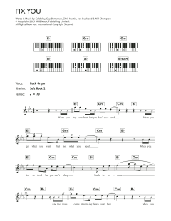 Fix You von Coldplay (Download) 